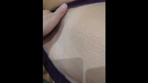 anallovess